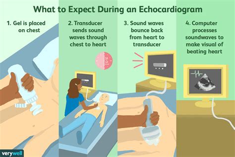 Echocardiogram: What It Shows, Purpose, Types, and Results.